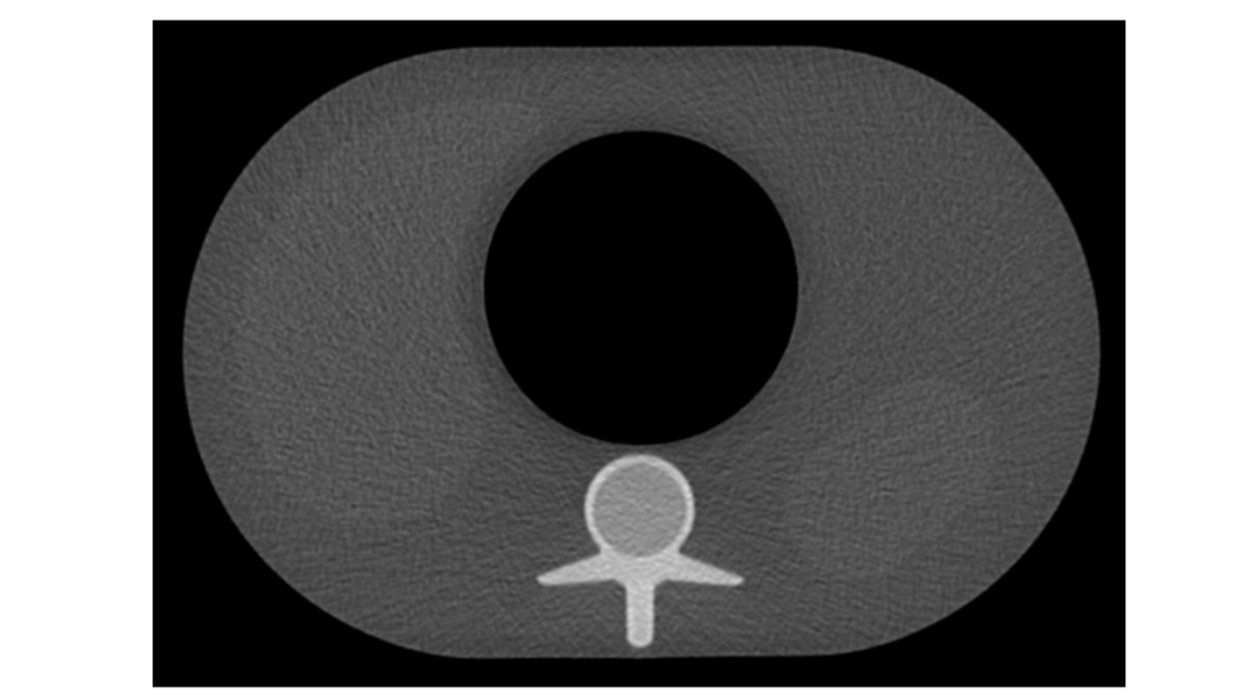 Phantom mô phỏng bụng Phantom mô phỏng bụng