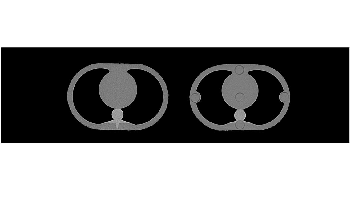 Phantom mô phỏng lồng ngực và bụng trẻ em Phantom mô phỏng lồng ngực và bụng trẻ em